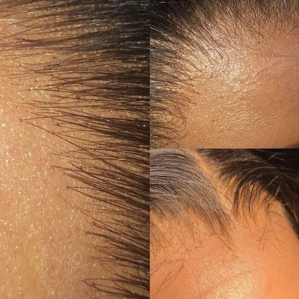 HD Lace Closure - Raw Hair