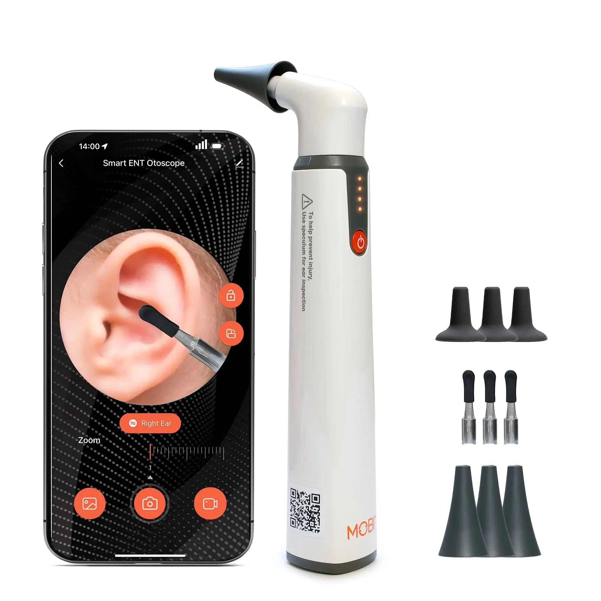 MOBI Ear, Nose & Throat Smart Otoscope Jr. HD Camera-1080P HD Lens, Multi-Axis Gyroscope, 6 LED Lights, 90  Min Use,